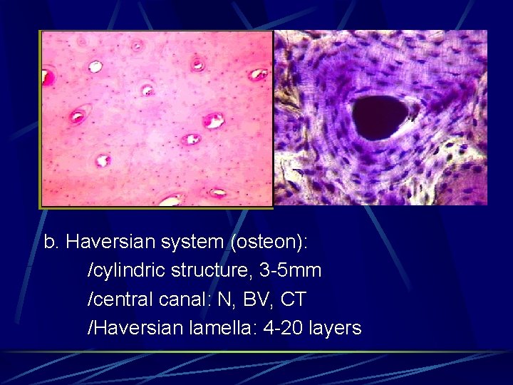 b. Haversian system (osteon): /cylindric structure, 3 -5 mm /central canal: N, BV, CT