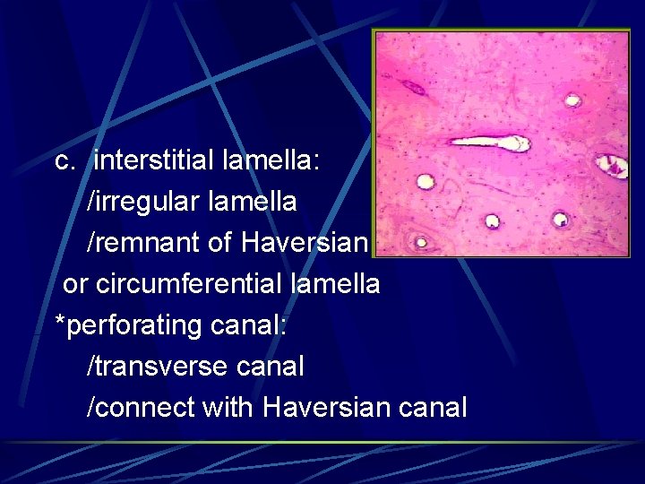 c. interstitial lamella: /irregular lamella /remnant of Haversian or circumferential lamella *perforating canal: /transverse
