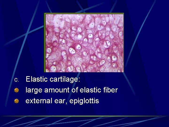 c. Elastic cartilage: large amount of elastic fiber external ear, epiglottis 