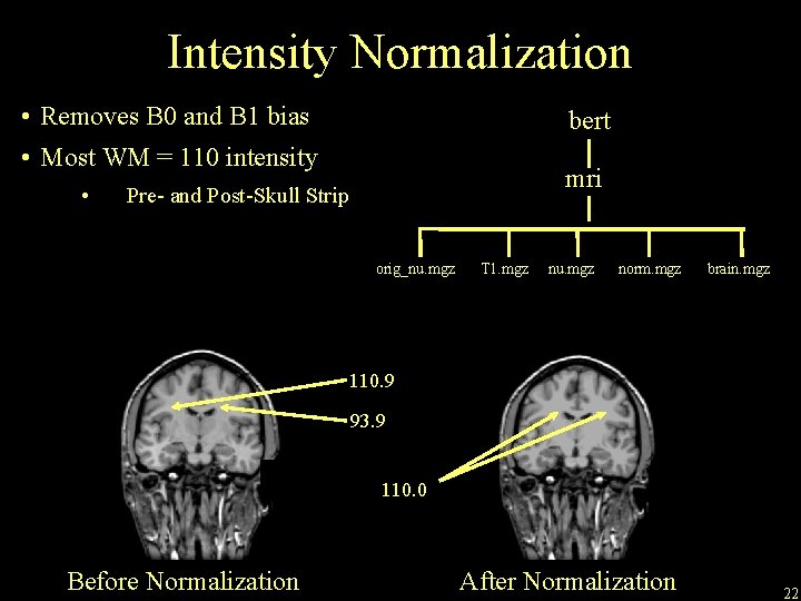 Intensity Normalization • Removes B 0 and B 1 bias bert • Most WM