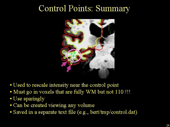 Control Points: Summary +++ • Used to rescale intensity near the control point •