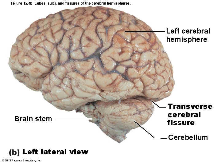 Figure 12. 4 b Lobes, sulci, and fissures of the cerebral hemispheres. Left cerebral