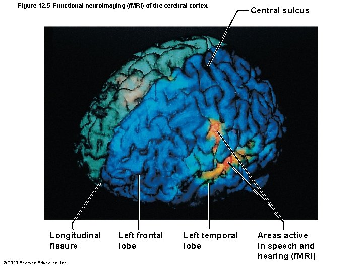 Figure 12. 5 Functional neuroimaging (f. MRI) of the cerebral cortex. Longitudinal fissure ©