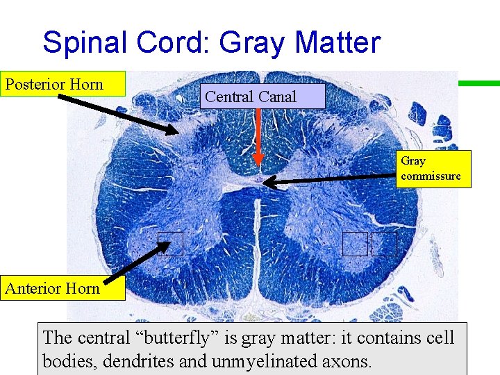 Spinal Cord: Gray Matter Posterior Horn Central Canal Gray commissure Anterior Horn The central