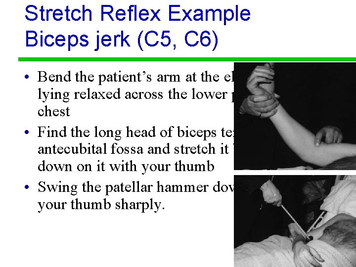 Stretch Reflex Example Biceps jerk (C 5, C 6) • Bend the patient’s arm