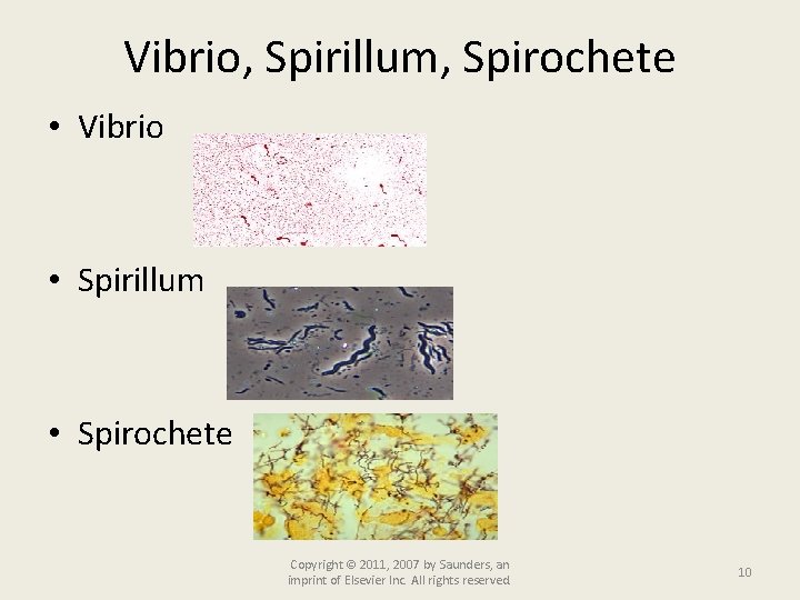 Vibrio, Spirillum, Spirochete • Vibrio • Spirillum • Spirochete Copyright © 2011, 2007 by