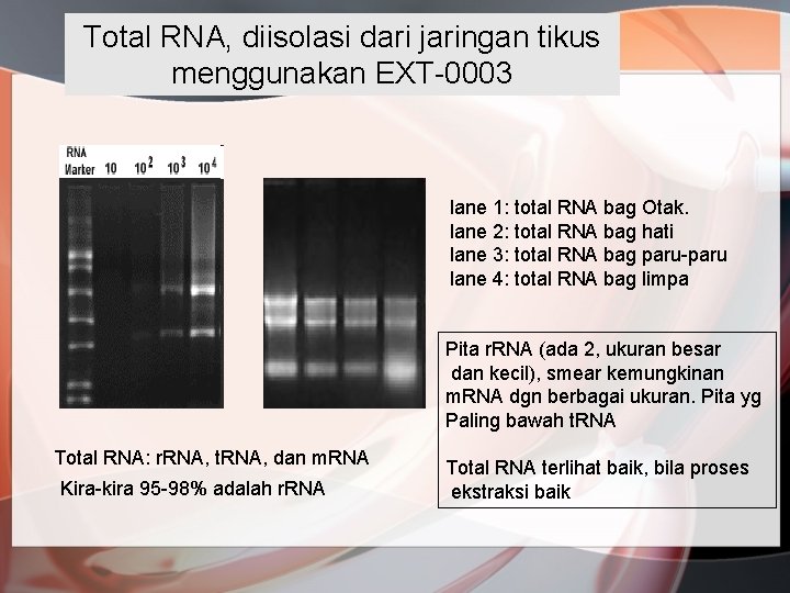 Total RNA, diisolasi dari jaringan tikus menggunakan EXT-0003 lane 1: total RNA bag Otak.