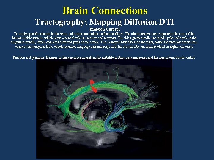 Brain Connections Tractography; Mapping Diffusion-DTI Emotion Control To study specific circuits in the brain,