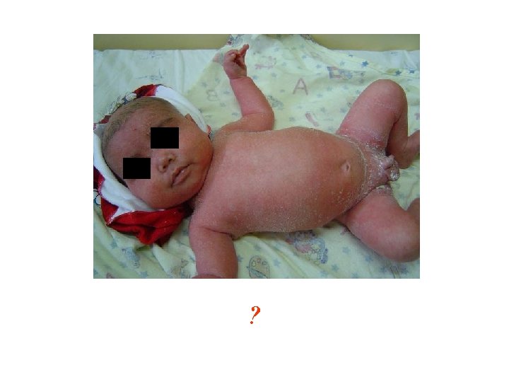 XX XX ? 