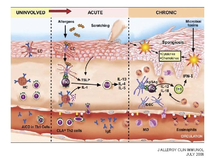 J ALLERGY CLIN IMMUNOL JULY 2006 