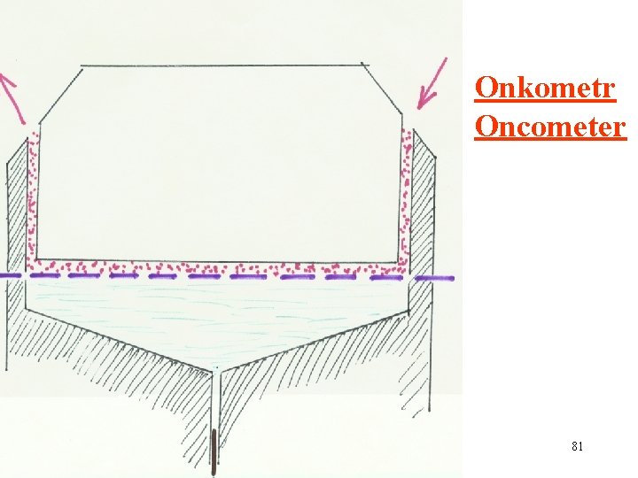 Onkometr Oncometer 81 