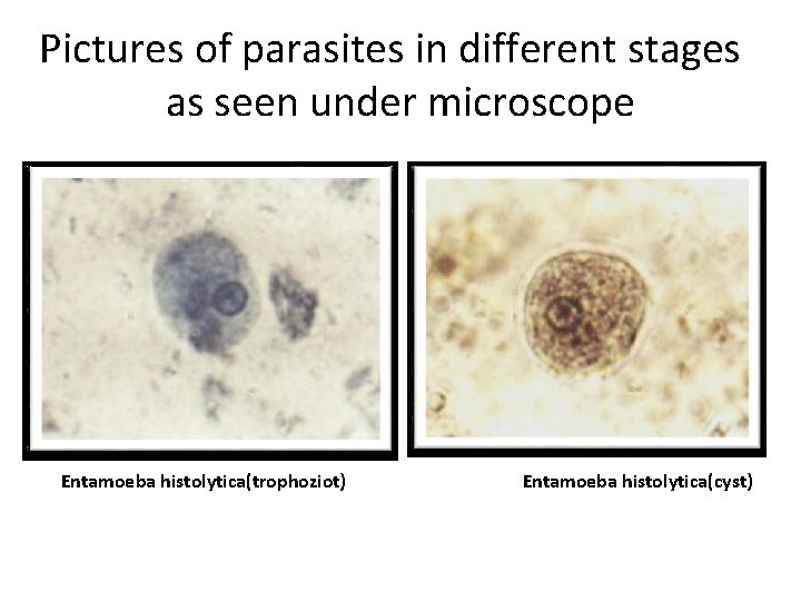Pictures of parasites in different stages as seen under microscope Entamoeba histolytica(trophoziot) Entamoeba histolytica(cyst)