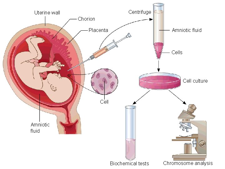 Centrifuge Uterine wall Chorion Amniotic fluid Placenta Cells Cell culture Cell Amniotic fluid Biochemical