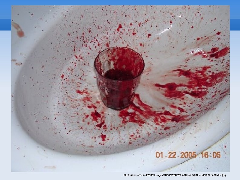 http: //www. naze. net/2005/images/2005%200122%20 jack%20 blood%20 in%20 sink. jpg 