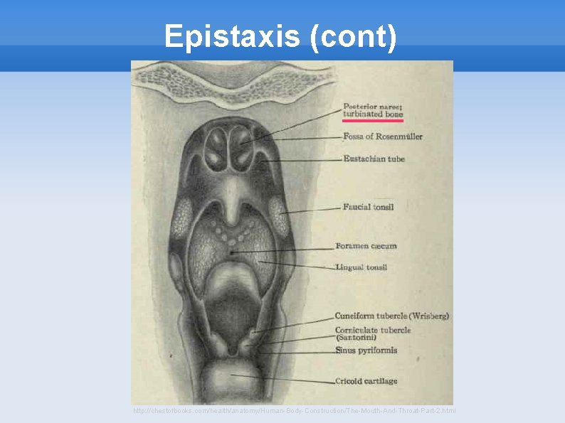 Epistaxis (cont) http: //chestofbooks. com/health/anatomy/Human-Body-Construction/The-Mouth-And-Throat-Part-2. html 