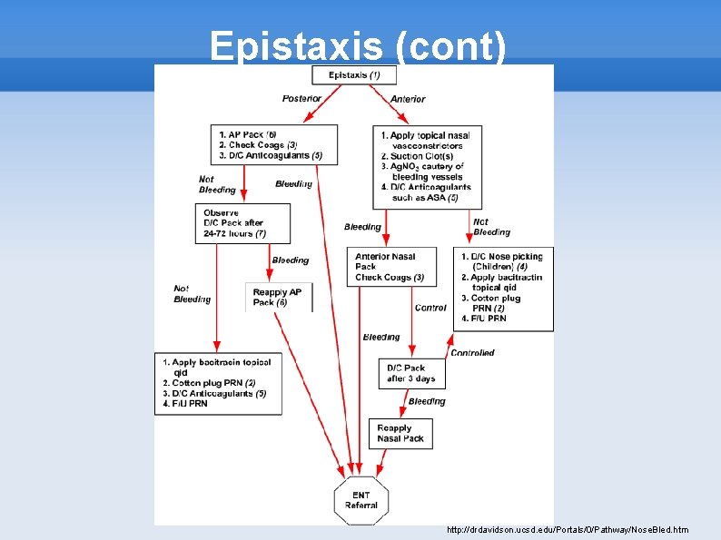 Epistaxis (cont) http: //drdavidson. ucsd. edu/Portals/0/Pathway/Nose. Bled. htm 