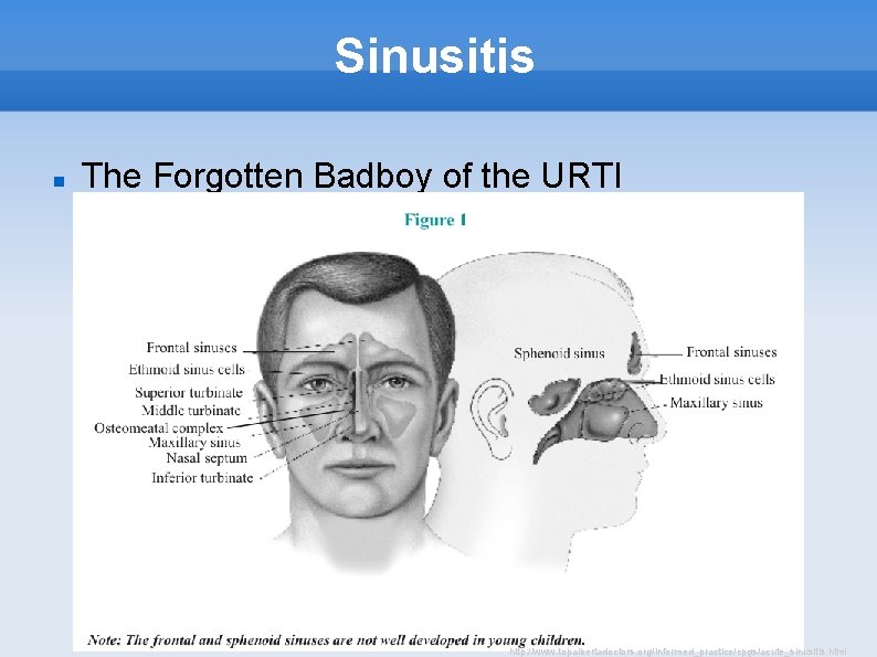 Sinusitis The Forgotten Badboy of the URTI http: //www. topalbertadoctors. org/informed_practice/cpgs/acute_sinusitis. html 