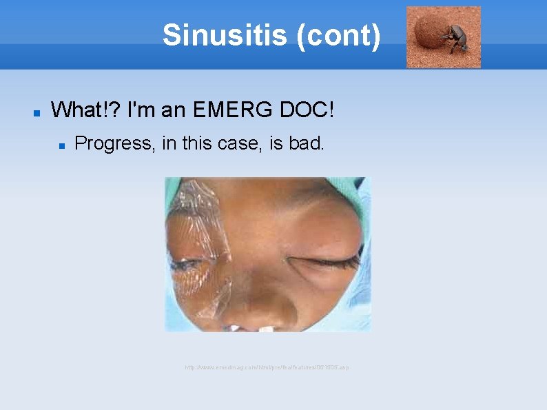 Sinusitis (cont) What!? I'm an EMERG DOC! Progress, in this case, is bad. http: