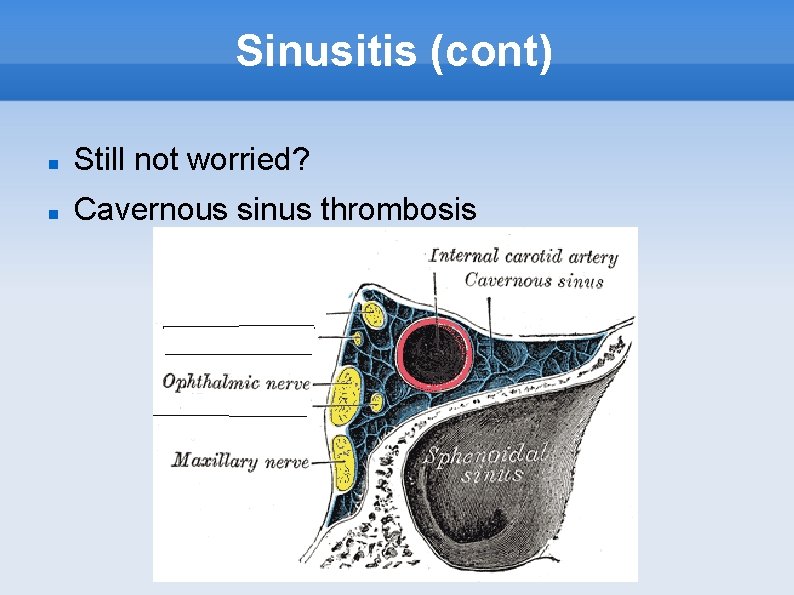 Sinusitis (cont) Still not worried? Cavernous sinus thrombosis 