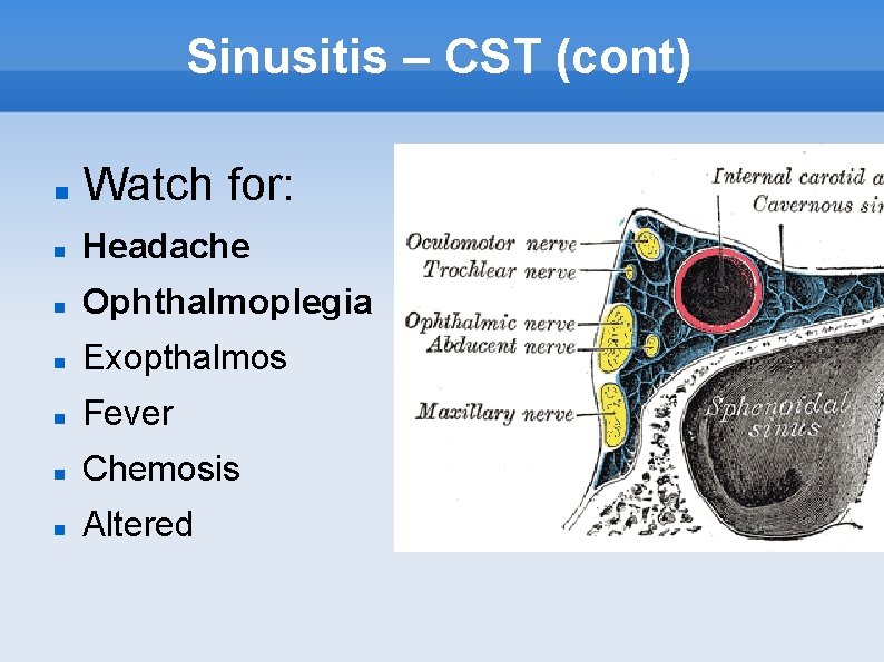 Sinusitis – CST (cont) Watch for: Headache Ophthalmoplegia Exopthalmos Fever Chemosis Altered 