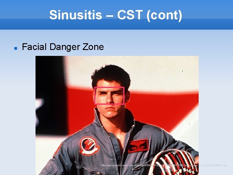 Sinusitis – CST (cont) Facial Danger Zone http: //resources 0. news. com. au/images/2008/07/22/va 1237320544789/Tom-Cruise-in-Top-Gun-6158917.