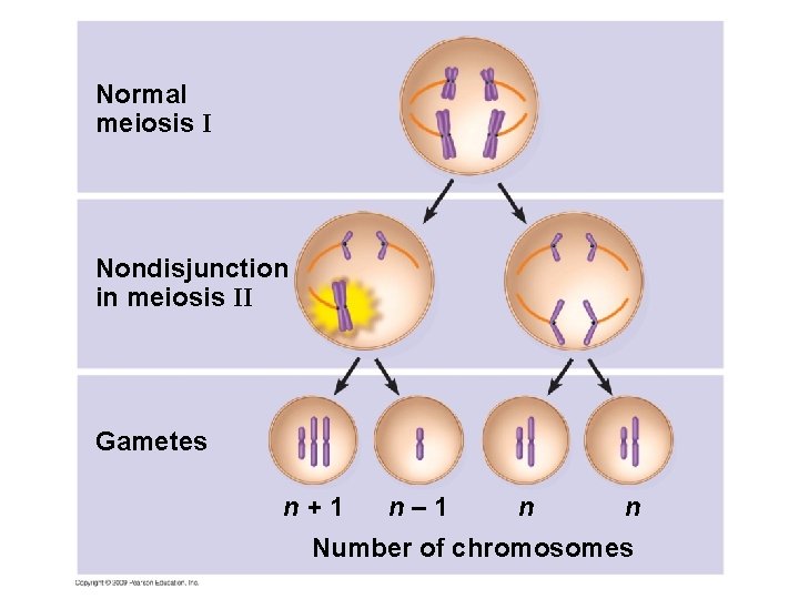 Normal meiosis I Nondisjunction in meiosis II Gametes n+1 n– 1 n n Number