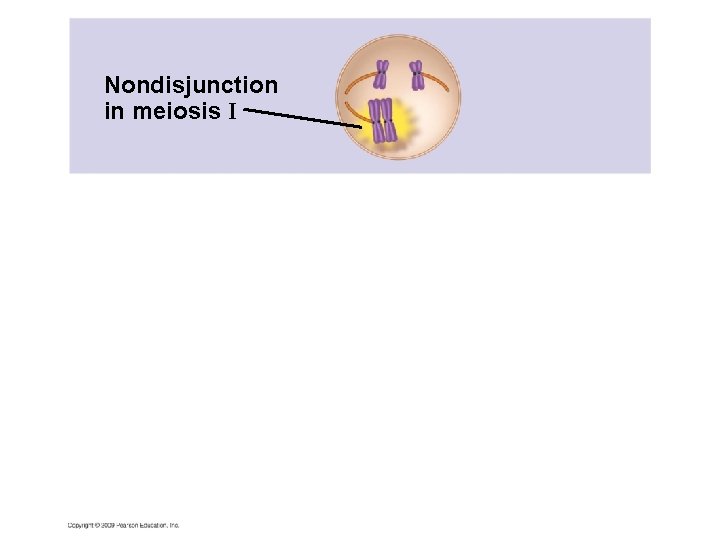 Nondisjunction in meiosis I 