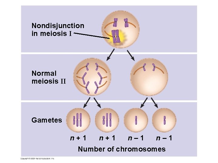 Nondisjunction in meiosis I Normal meiosis II Gametes n+1 n– 1 Number of chromosomes