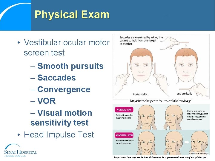Physical Exam • Vestibular ocular motor screen test – Smooth pursuits – Saccades –