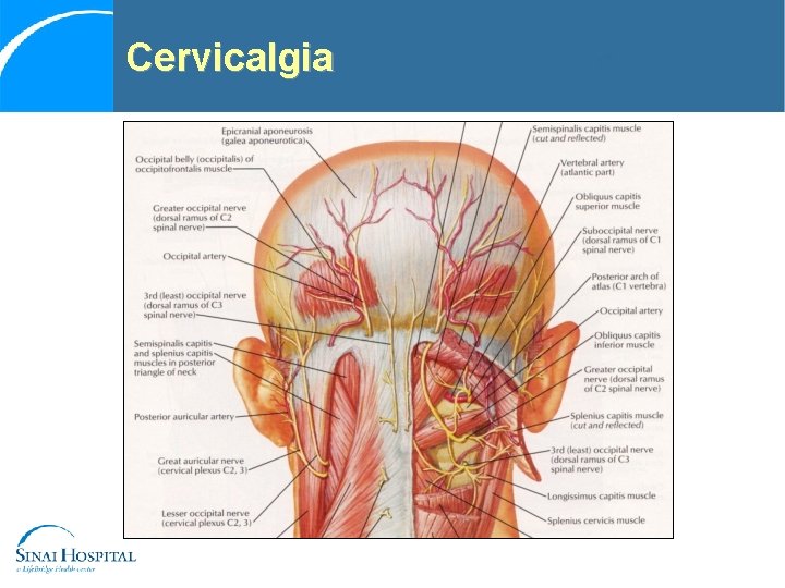 Cervicalgia 