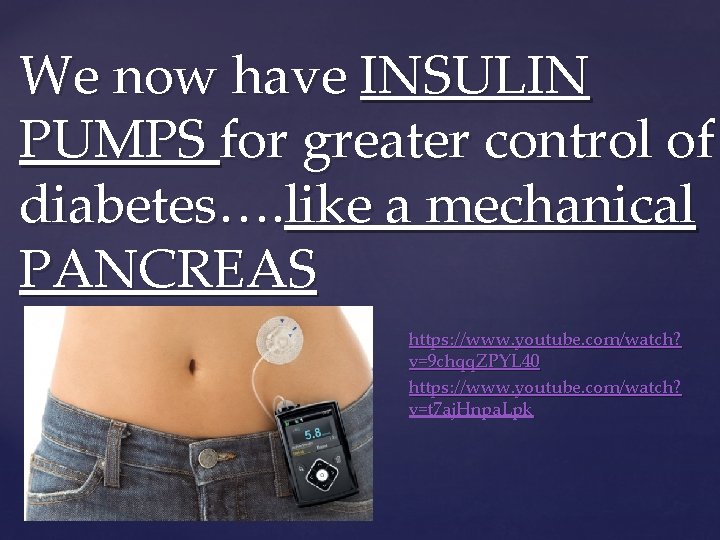 We now have INSULIN PUMPS for greater control of diabetes…. like a mechanical PANCREAS