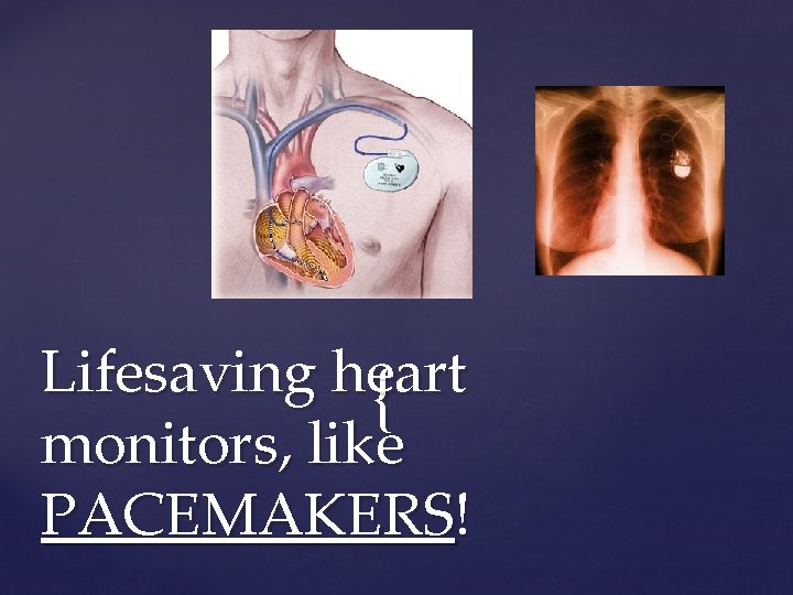 Lifesaving heart { monitors, like PACEMAKERS! 