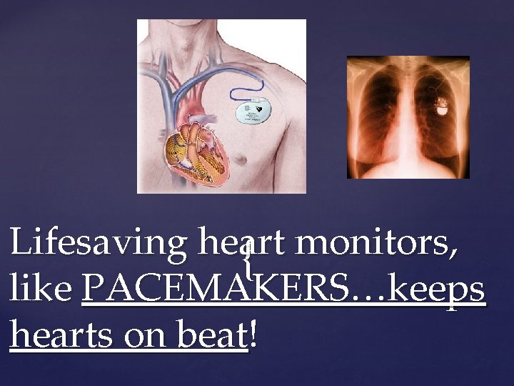 Lifesaving heart monitors, { like PACEMAKERS…keeps hearts on beat! 