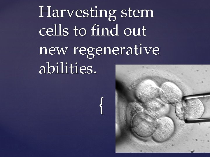 Harvesting stem cells to find out new regenerative abilities. { 