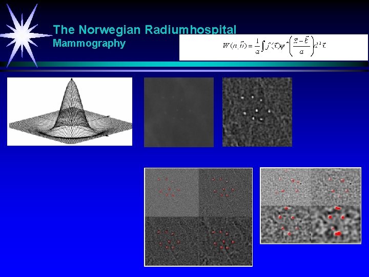 The Norwegian Radiumhospital Mammography 