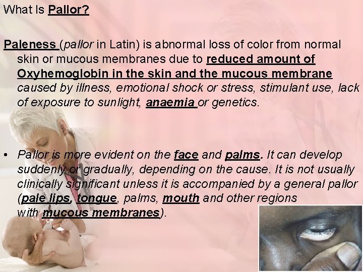 What Is Pallor? Paleness (pallor in Latin) is abnormal loss of color from normal