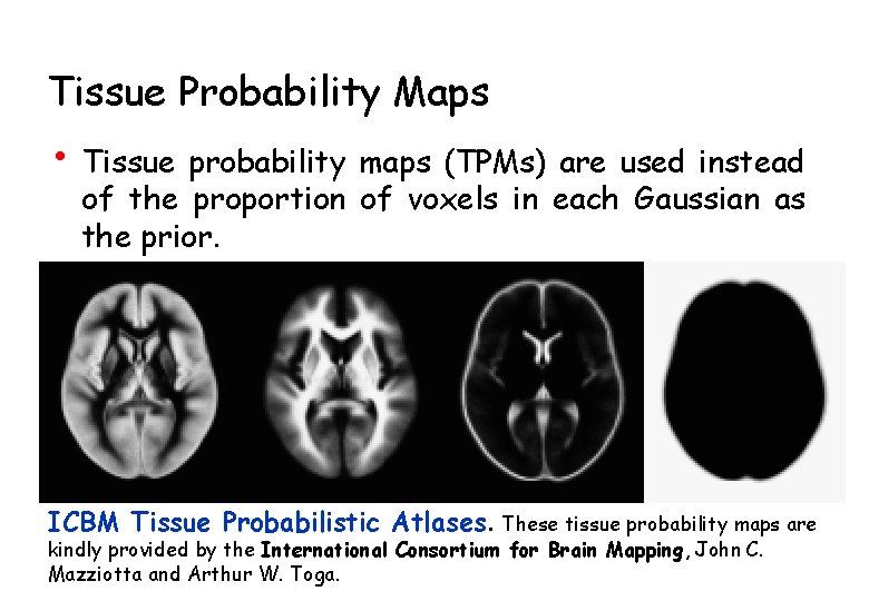 Tissue Probability Maps • Tissue probability maps (TPMs) are used instead of the proportion