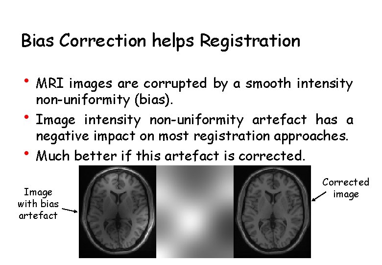 Bias Correction helps Registration • MRI images are corrupted by a smooth intensity •
