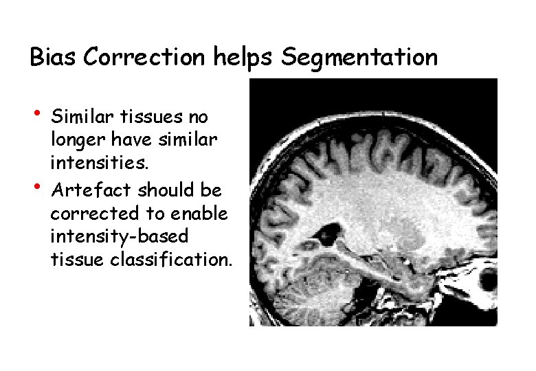 Bias Correction helps Segmentation • Similar tissues no • longer have similar intensities. Artefact