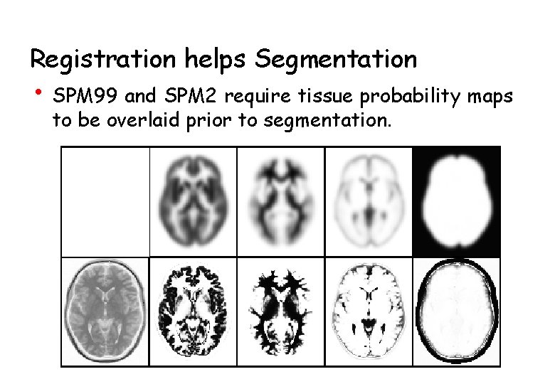 Registration helps Segmentation • SPM 99 and SPM 2 require tissue probability maps to