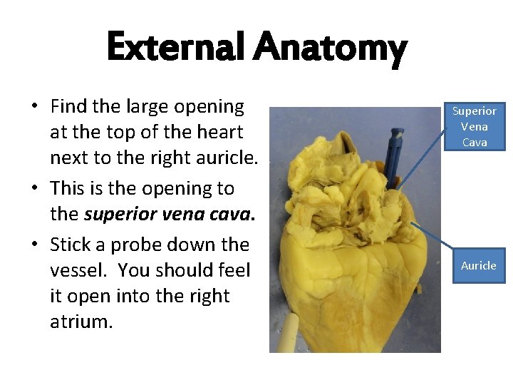 External Anatomy • Find the large opening at the top of the heart next