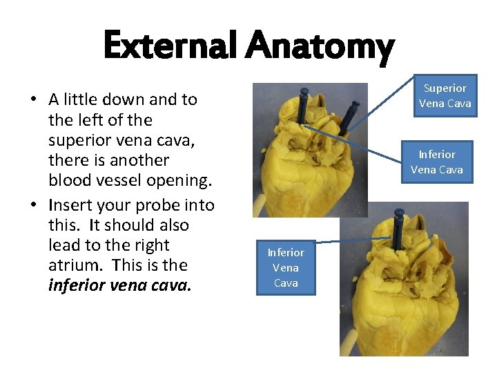 External Anatomy • A little down and to the left of the superior vena
