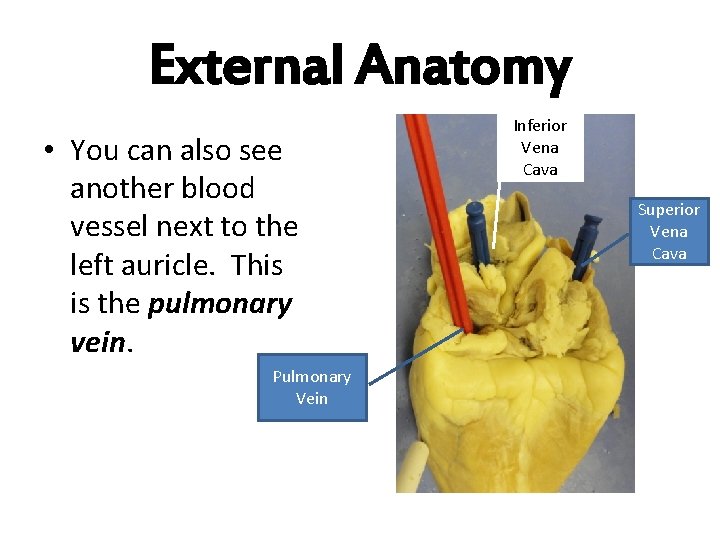 External Anatomy • You can also see another blood vessel next to the left