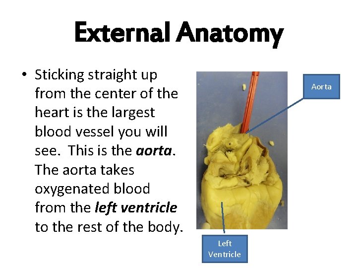 External Anatomy • Sticking straight up from the center of the heart is the