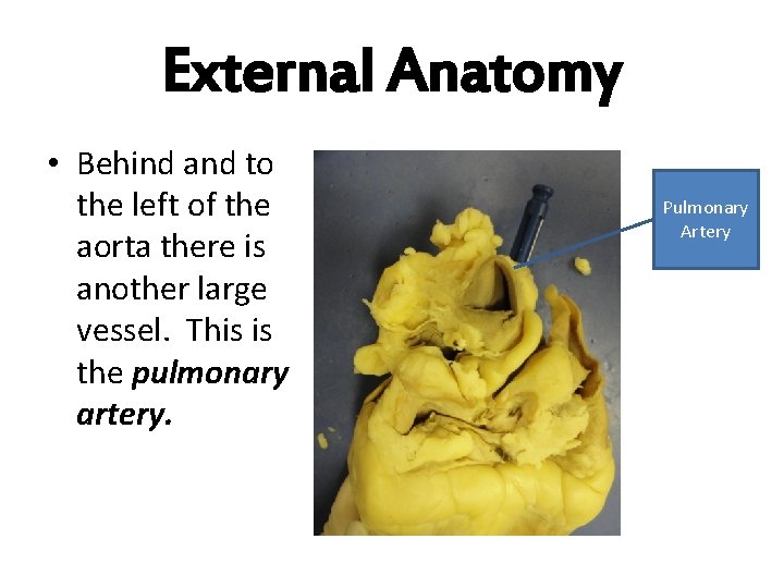 External Anatomy • Behind and to the left of the aorta there is another
