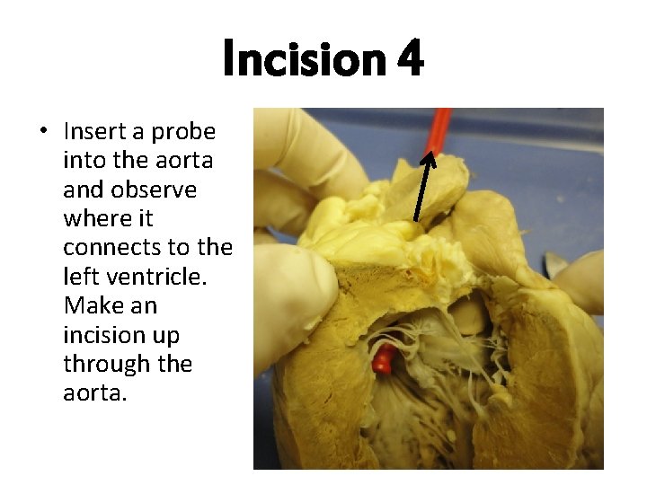 Incision 4 • Insert a probe into the aorta and observe where it connects