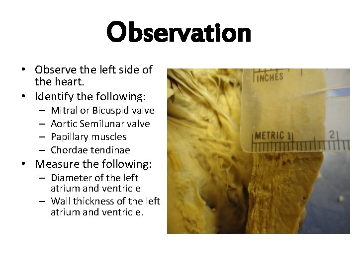 Observation • Observe the left side of the heart. • Identify the following: –