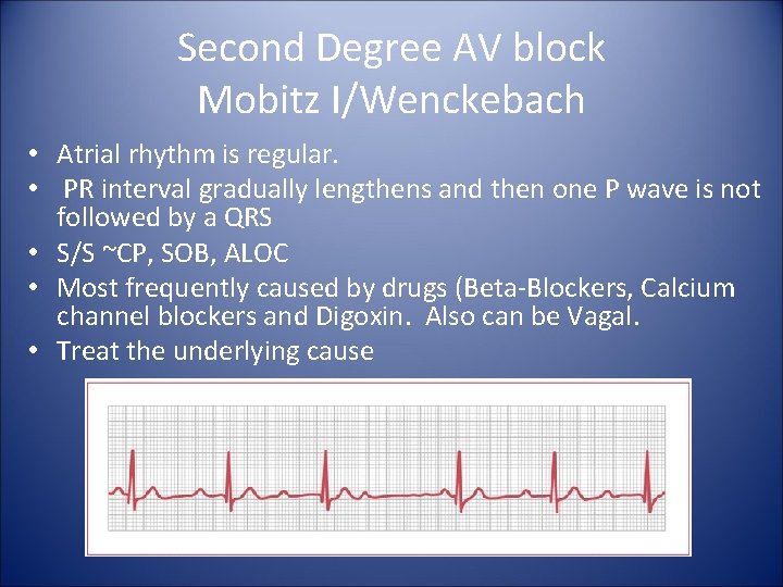 Second Degree AV block Mobitz I/Wenckebach • Atrial rhythm is regular. • PR interval