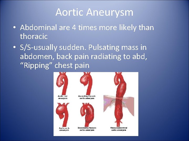 Aortic Aneurysm • Abdominal are 4 times more likely than thoracic • S/S-usually sudden.