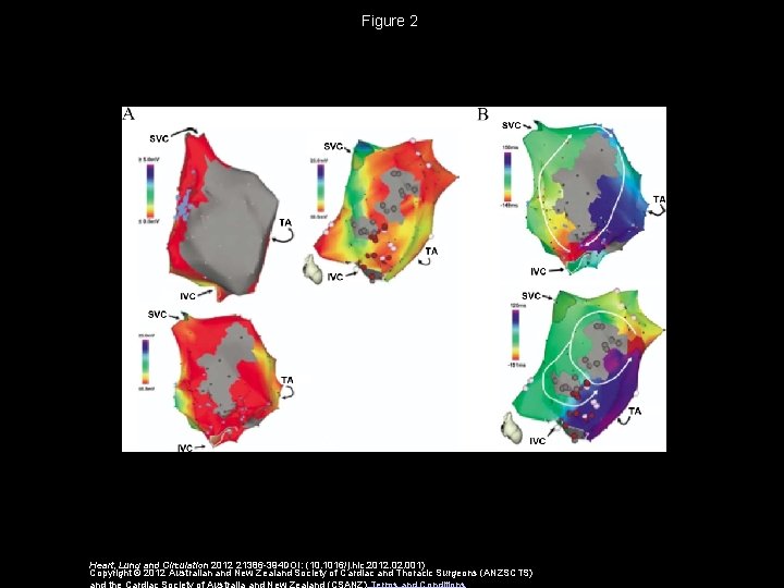 Figure 2 Heart, Lung and Circulation 2012 21386 -394 DOI: (10. 1016/j. hlc. 2012.